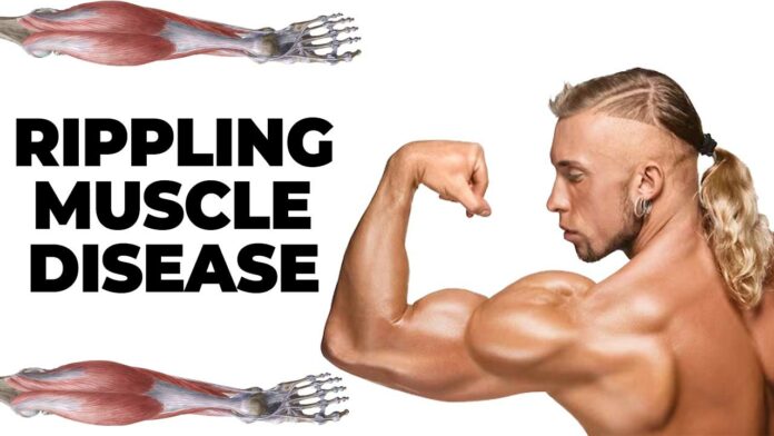 Rippling Muscle Disease