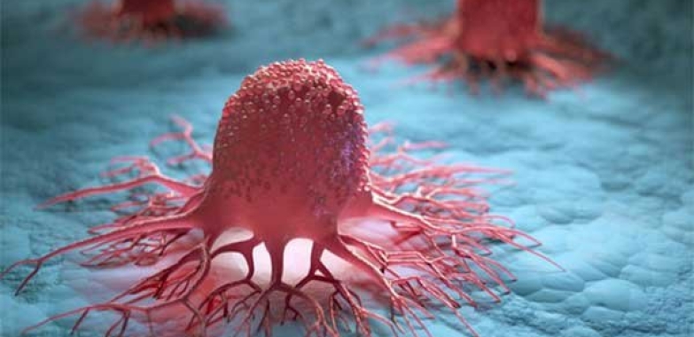 Cancer: What it is, Why it Happens, How to Stop it, and More