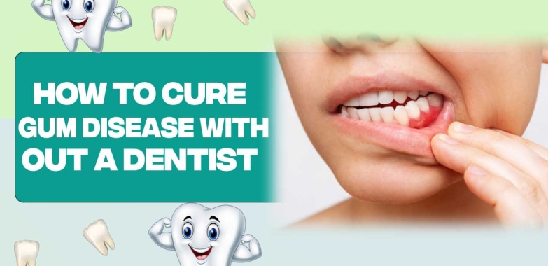 How to Cure Gum Disease Without a Dentist: Natural Remedies for Optimal Gum Health